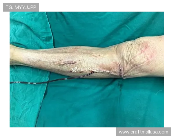 武磊膝盖微骨折手术欧名医主刀